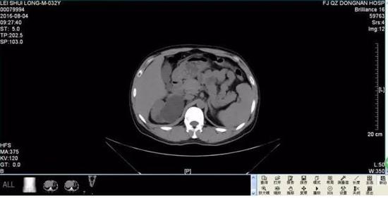 �������ᱳʹһ�龹��4���� ������Լʮ���һ