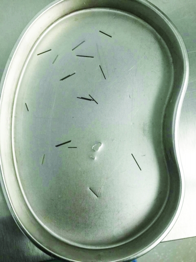 13��Ů���ֱ�����16��Ǧ��о ���ˣ�����ѧϰѹ����